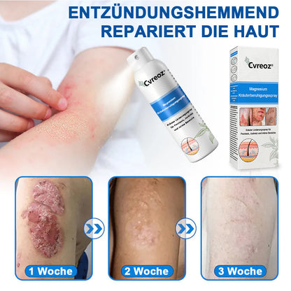 Offizieller Shop🎁: Cvreoz® Magnesium Kräuter Hautspray ⚕️ Entspricht den deutschen Hautpflege-Standards