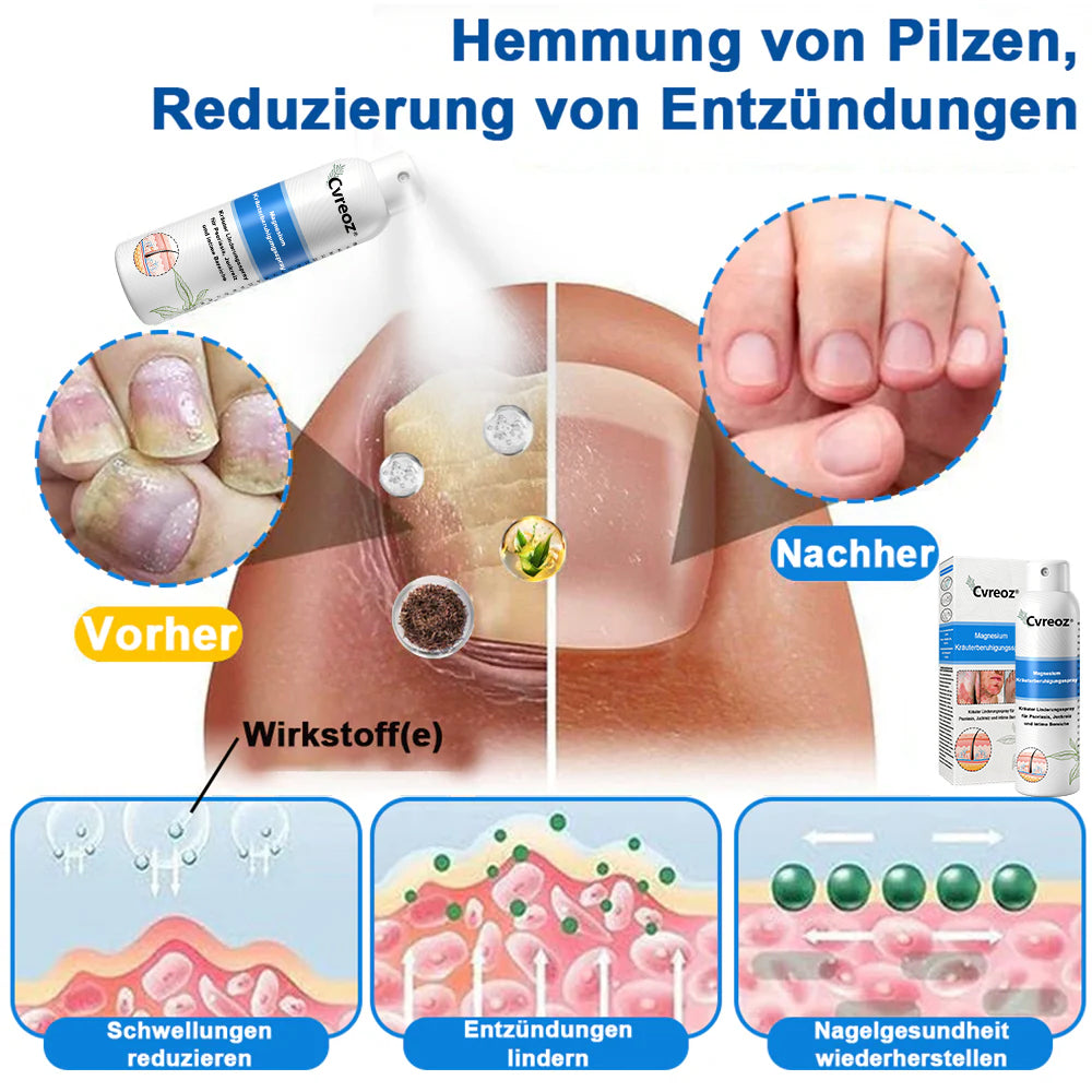 Offizieller Shop🎁: Cvreoz® Magnesium Kräuter Hautspray ⚕️ Entspricht den deutschen Hautpflege-Standards