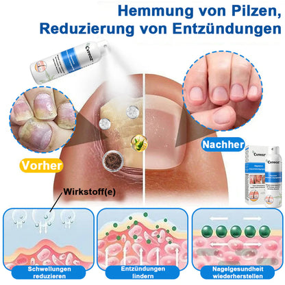 Offizieller Shop🎁: Cvreoz® Magnesium Kräuter Hautspray ⚕️ Entspricht den deutschen Hautpflege-Standards
