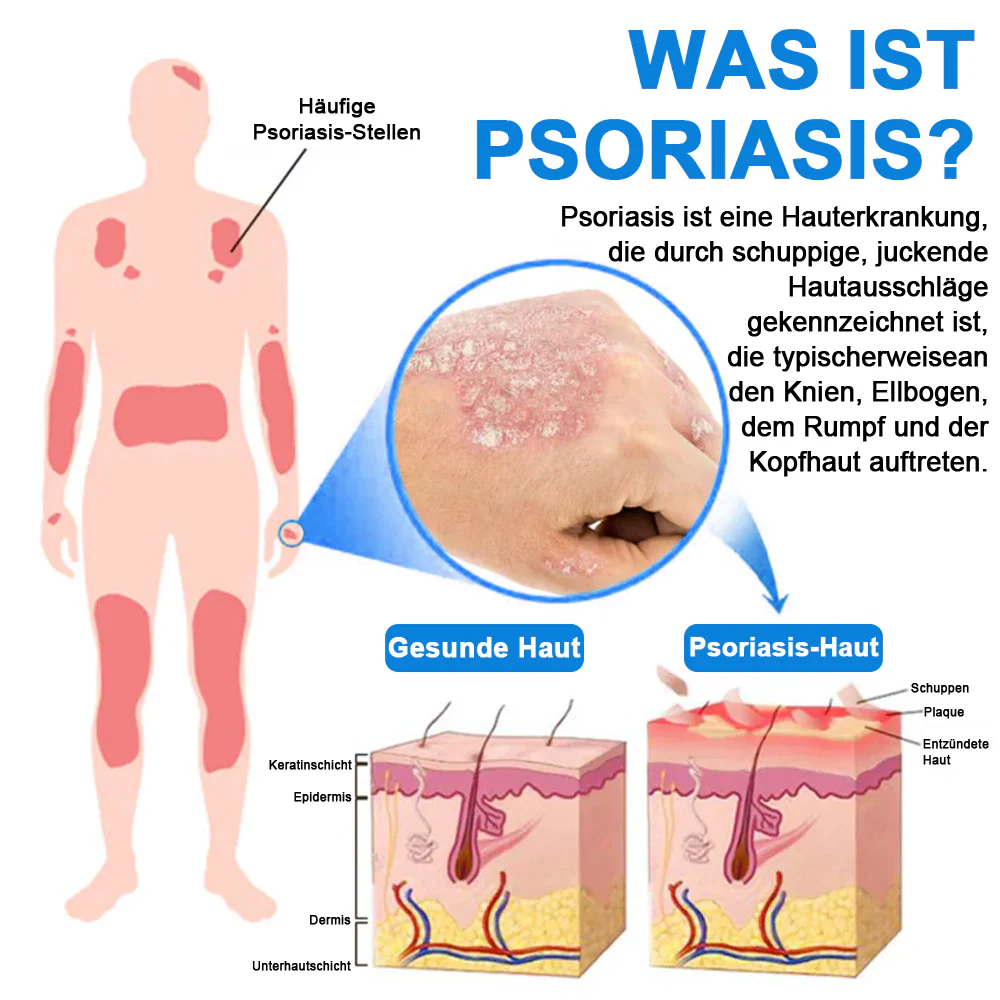 Offizieller Shop🎁: Cvreoz® Magnesium Kräuter Hautspray ⚕️ Entspricht den deutschen Hautpflege-Standards