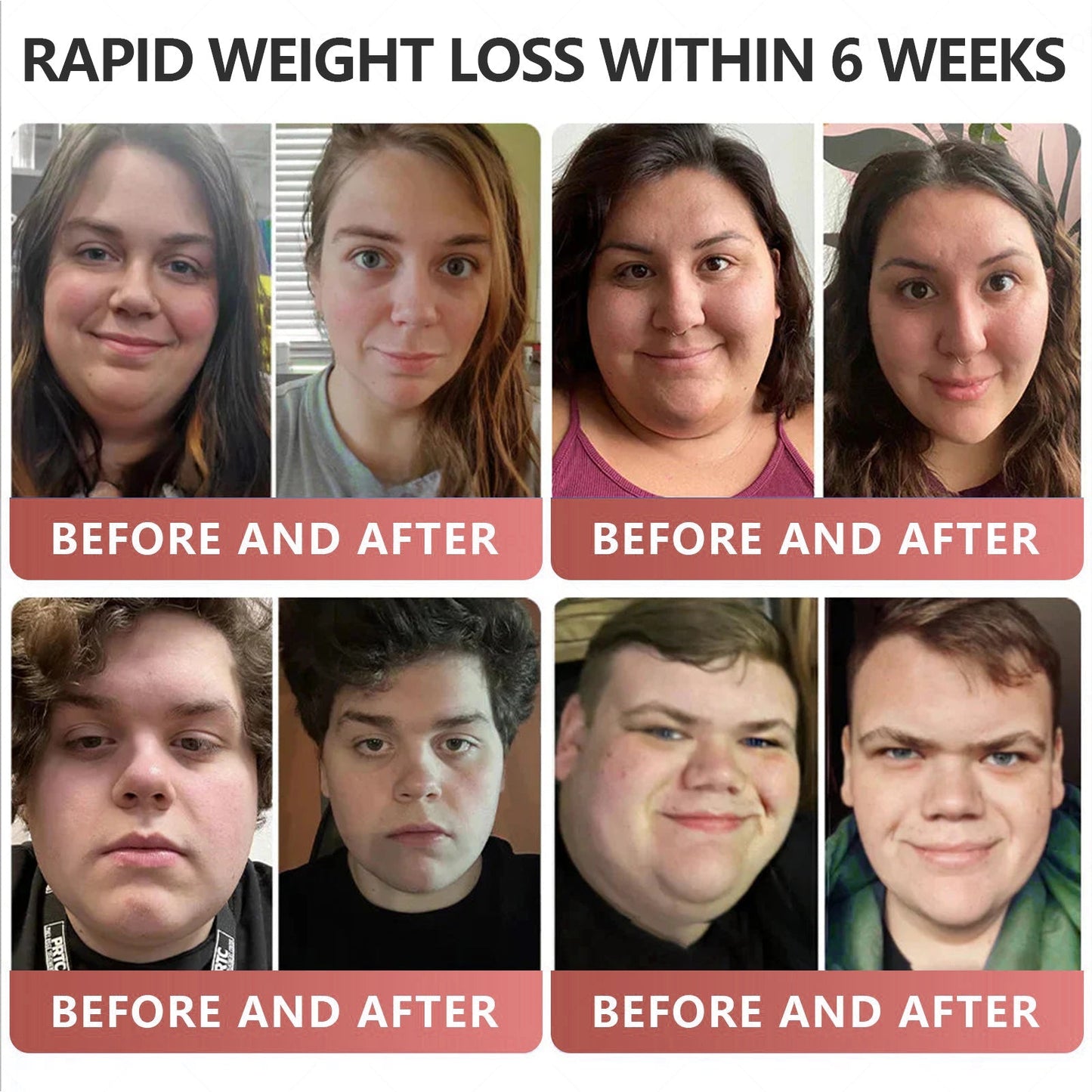 GLP-1 Pat🎊 - Slimming, Skin Tightening, Blood Sugar Support, No Injection, 7- Day Result