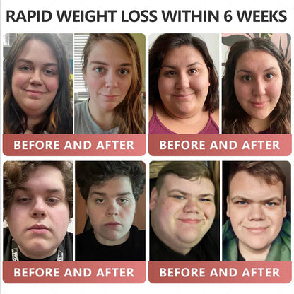 GLP-1 Pat🎊 - Slimming, Skin Tightening, Blood Sugar Support, No Injection, 7- Day Result