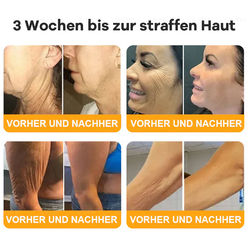 Hergestellt und versendet aus Deutschland  ✨TLOPA® Bienengift Hautregenerationscreme LETZTER TAG 80 % RABATT