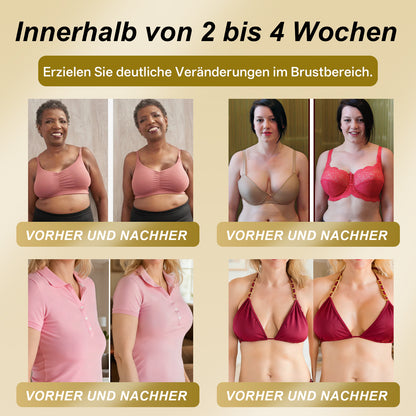 【Offizieller Flagship-Store】𝐇𝐔𝐃𝐑𝐎𝐒® Gelée Royale STRAFFENDES LIFTING-PFLASTER — Sicher in der Stillzeit anwendbar