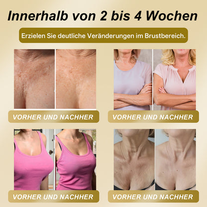 【Offizieller Flagship-Store】𝐇𝐔𝐃𝐑𝐎𝐒® Gelée Royale STRAFFENDES LIFTING-PFLASTER — Sicher in der Stillzeit anwendbar