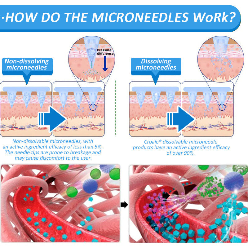 CROAIE ®🌟 Nano Microneedle Patch with SMGT-GLP-1 & Matrixyl 3000 – Slimming, Skin Tightening, Blood Sugar Support, No Injection, 7-Day Result