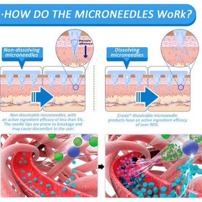 CROAIE ®🌟 Nano Microneedle Patch with SMGT-GLP-1 & Matrixyl 3000 – Slimming, Skin Tightening, Blood Sugar Support, No Injection, 7-Day Result