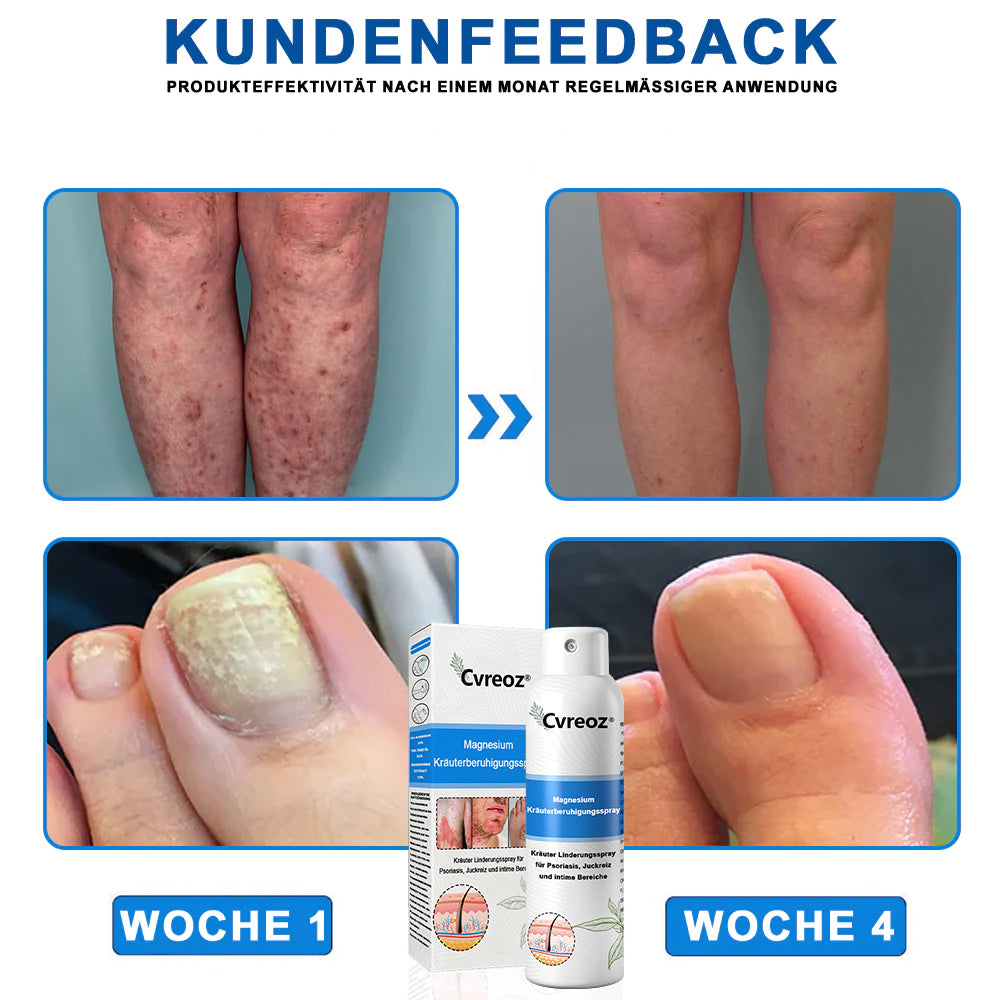 Offizieller Shop🎁: Cvreoz® Magnesium Kräuter Hautspray ⚕️ Entspricht den deutschen Hautpflege-Standards