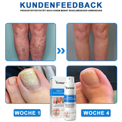 Offizieller Shop🎁: Cvreoz® Magnesium Kräuter Hautspray ⚕️ Entspricht den deutschen Hautpflege-Standards