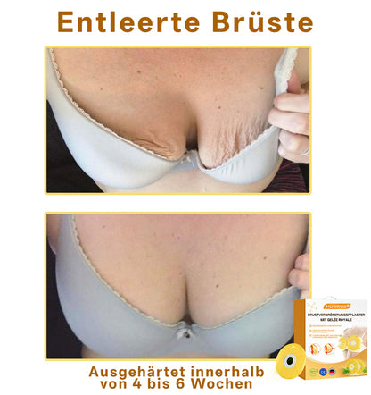 【Offizieller Flagship-Store】𝐇𝐔𝐃𝐑𝐎𝐒® Brustvergrößerungspflaster mit Gelée Royale — Sicher in der Stillzeit anwendbar