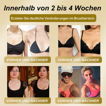 【Offizieller Flagship-Store】𝐇𝐔𝐃𝐑𝐎𝐒® Gelée Royale STRAFFENDES LIFTING-PFLASTER — Sicher in der Stillzeit anwendbar